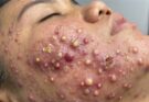 Soothing Facial Treatment for Stress Relief at a Luxury Spa: Achieve Inner Peace